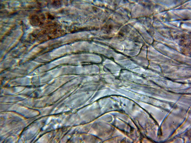 Ciboria batschiana 10 - Excípulo medular 2